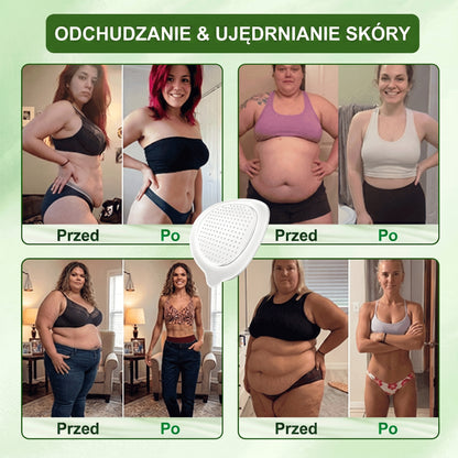 Oficjalny sklep| 👩‍⚕️M𝘜𝗥𝖶𝑶𝑁® MORINGA Z BERBERYNA 10W1 Zaawansowany Nano-Mikroigłowy Plaster (Stosować raz na dobę, zauważalne efekty w ciągu 7 dni) ✅ Otyłość, cukrzyca, bezdech senny oraz schorzenia stawó