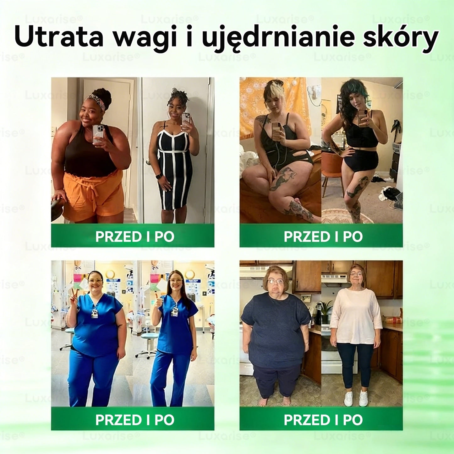 Oficjalny sklep| 👩‍⚕️𝗟𝘂𝘅𝗮𝗿𝗶𝘀𝗲® MORINGA Z BERBERYNA 10W1 Zaawansowany Nano-Mikroigłowy Plaster (Stosować raz na dobę, zauważalne efekty w ciągu 7 dni) ✅ Otyłość, cukrzyca, bezdech senny oraz schorzenia stawó🍉